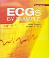 ECGs by Example, 3e