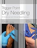 Trigger Point Dry Needling An Evidence And Clinicalbased Approach