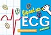 Flip and See ECG