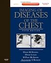 Imaging of Diseases of the Chest: Expert Consult - Online and Print