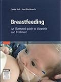 Breastfeeding An Atlas Of Diagnosis And Treatment