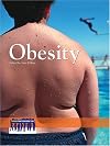 Obesity (Issues That Concern You)