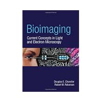 Bioimaging: Current Techniques in Light and Electron Microscopy