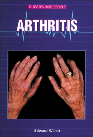 Arthritis book cover