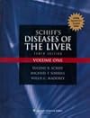 Schiff's diseases of the liver