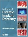 Fundamentals of Esthetic Dentistry, Second Edition