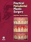Practical Periodontal Plastic Surgery