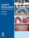 Implant Restorations: A Step-by-Step Guide