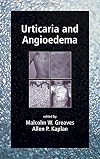 Urticaria and Angioedema, Second Edition