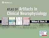 Atlas Of Artifacts In Clinical Neurophysiology