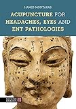 Acupuncture For Headaches Eyes And Ent Pathologies