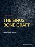 The Sinus Bone Graft