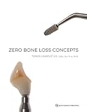 Zero Bone Loss Concepts