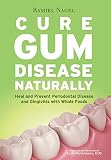 Cure Gum Disease Naturally Heal Gingivitis And Periodontal Disease With Whole Foods