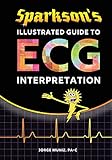 Sparksons Illustrated Guide To Ecg Interpretation