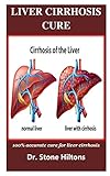 Liver Cirrhosis Cure 100 Accurate Cure For Liver Cirrhosis
