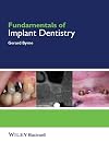 Fundamentals of Implant Dentistry