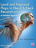 Local And Regional Flaps In Head And Neck Reconstruction A Practical Approach