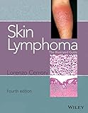 Skin Lymphoma The Illustrated Guide