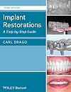Implant Restorations: A Step-by-Step Guide