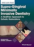 Supragingival Minimally Invasive Dentistry A Healthier Approach To Esthetic Restorations