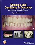 Diseases And Conditions In Dentistry An Evidencebased Reference