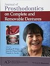 Journal of prosthodontics on complete and removable dentures