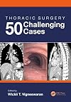 Thoracic Surgery: 50 Challenging cases