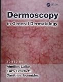 Dermoscopy In General Dermatology