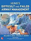 Hung's difficult and failed airway management