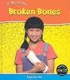 Broken Bones (It's Not Catching)