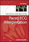 The Nuts and bolts of Paced ECG Interpretation