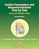 Cardiac Pacemakers And Resynchronization Step By Step An Illustrated Guide