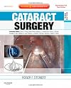 Cataract surgery