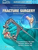 HARBORVIEW ILLUSTRATED TIPS & TRICS IN FRACTURE SURGERY