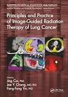 Principles and practice of image-guided radiation therapy of lung cancer