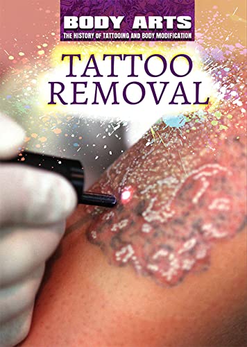Cover of Tattoo Removal