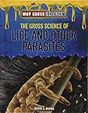 The Gross Science Of Lice And Other Parasites Way Gross Science