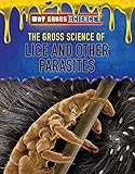The Gross Science Of Lice And Other Parasites Way Gross Science
