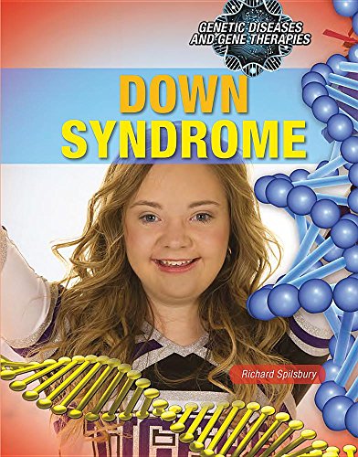Cover of Down Syndrome