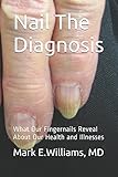 Nail The Diagnosis What Our Fingernails Reveal About Our Health And Illnesses