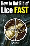 How To Get Rid Of Lice Fast An Essential Guide To Getting Rid Of Head Lice For Good