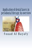 Application Of Dental Lasers In Periodontal Therapy An Overview Lasers In Periodontal Therapy
