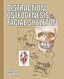 Distraction Osteogenesis Of The Facial Skeleton
