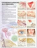 Understanding Allergies Anatomical Chart