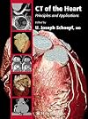 CT of the Heart: Principles and Applications (Contemporary Cardiology)
