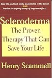 Scleroderma The Proven Therapy That Can Save Your Life