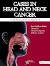 Cases in head and neck cancer : a multidisciplinary approach