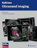 Ultrasound Imaging