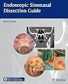 Endoscopic Sinonasal Dissection Guide: Including Orbit and Skull Base
